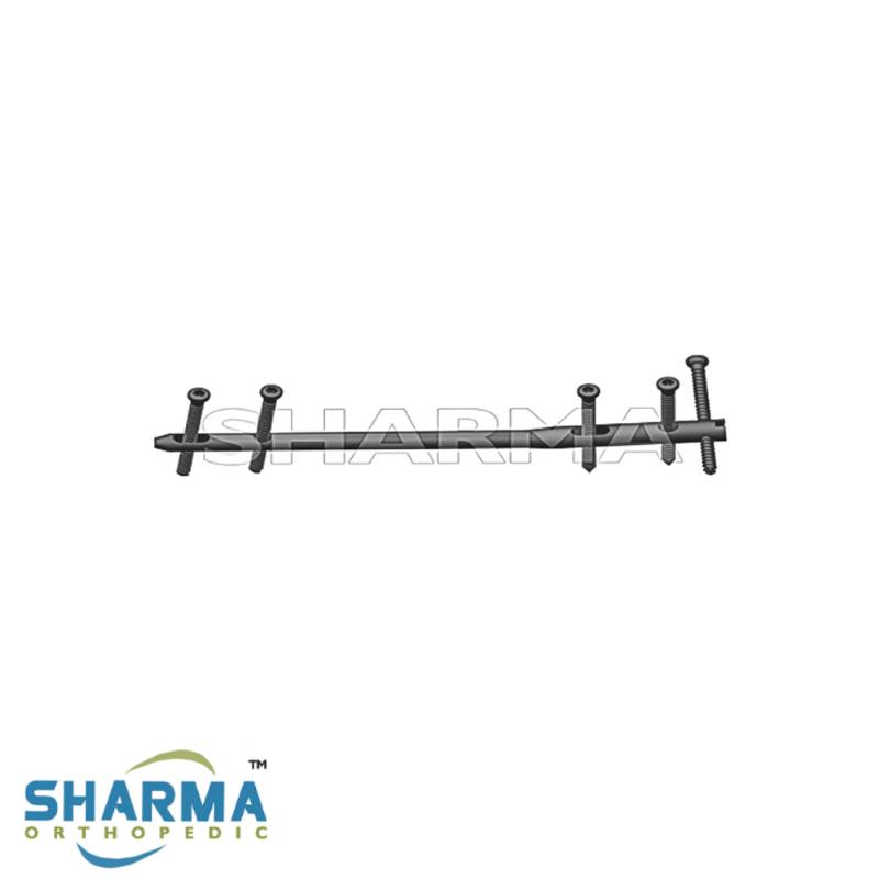 SHARMA ORTHOPEDIC - Стрижень для артродезу гомілковостопного суглоба ELEGANT (правий)